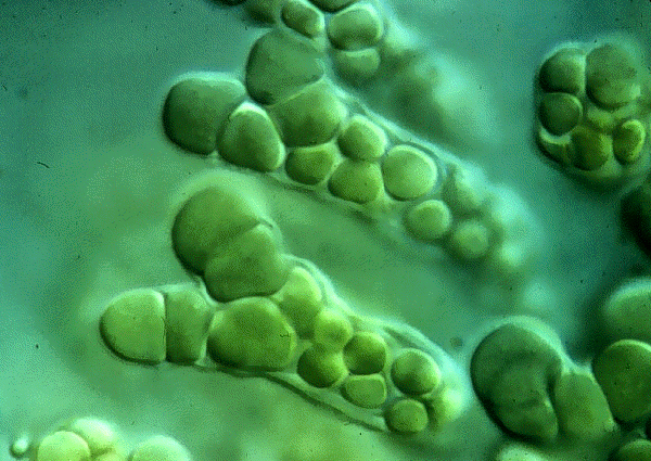 Cyanobakterier